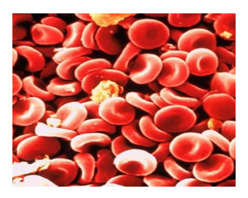 En verdad ¿Sabes que es la anemia?